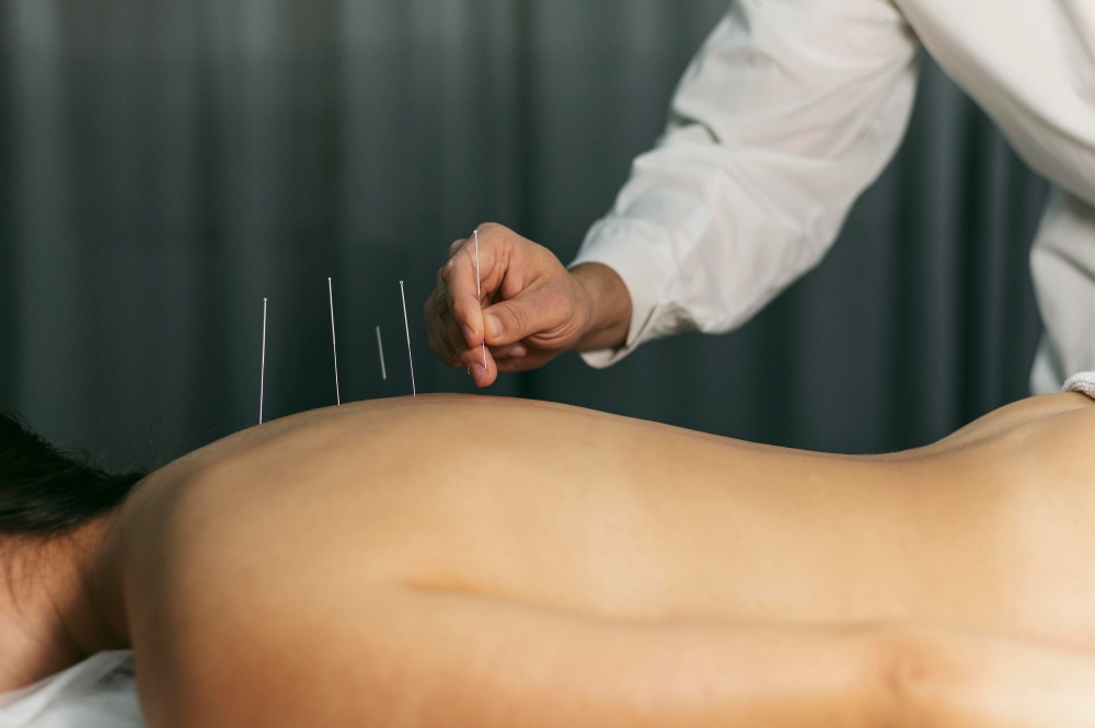 Expert Acupuncture Services in Chicago, IL
