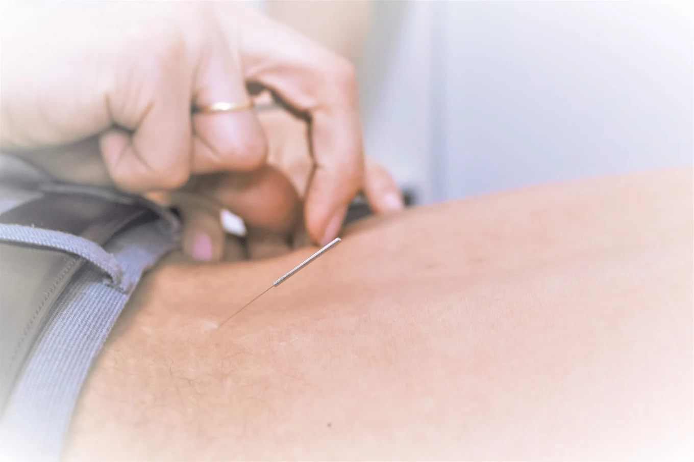 How Holistic Acupuncture Can Enhance Your Health in Chicago