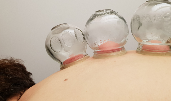 How Holistic Acupuncture Can Enhance Your Health in Chicago