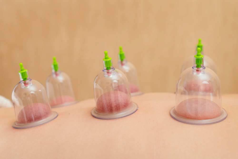 How to Choose the Best Acupuncturist in Chicago, IL for Your Health Needs