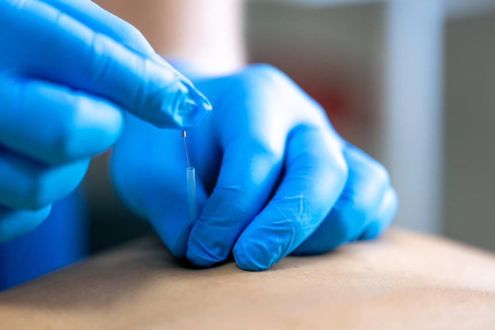 Best Acupuncture Clinic in Chicago  Acupuncture Center Chicago Guide