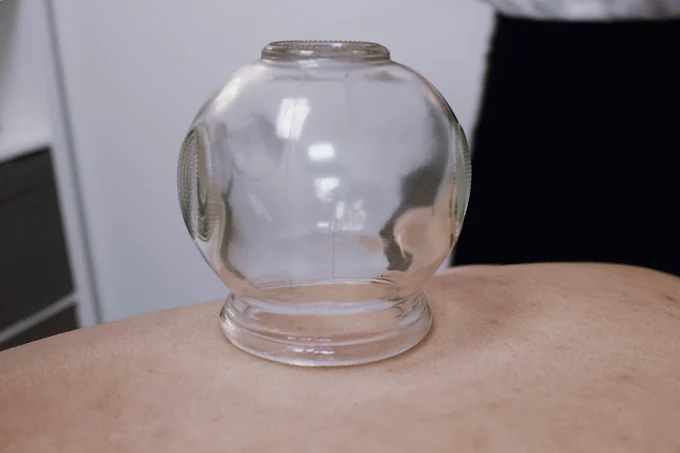 First Acupuncture Visit in Chicago, IL: Beginner’s Guide